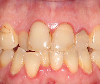 Before - Dentaria Dental