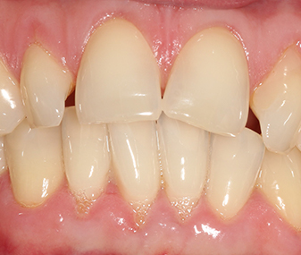 Before - Dentaria Dental