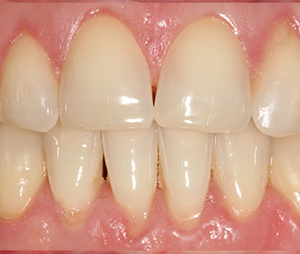 After - Dentaria Dental