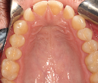 Before - Dentaria Dental