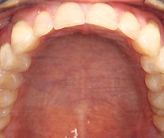 After - Dentaria Dental