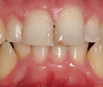 Before - Dentaria Dental