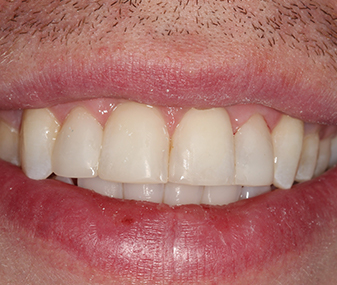 After - Dentaria Dental