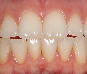 Before - Dentaria Dental