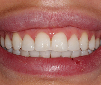 After - Dentaria Dental