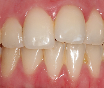 Before - Dentaria Dental