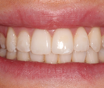 After - Dentaria Dental