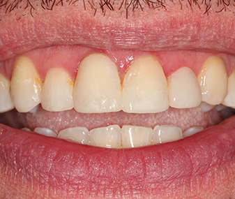 After - Dentaria Dental