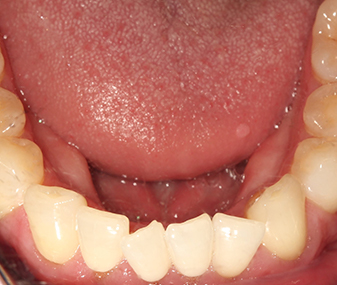 Before - Dentaria Dental