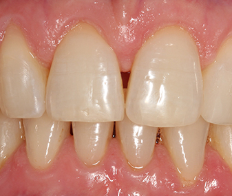 Before - Dentaria Dental