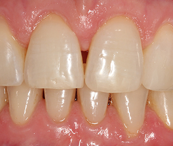After - Dentaria Dental