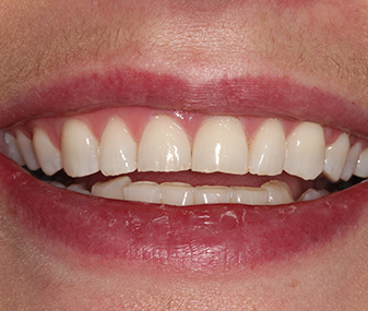 Before - Dentaria Dental