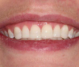 After - Dentaria Dental