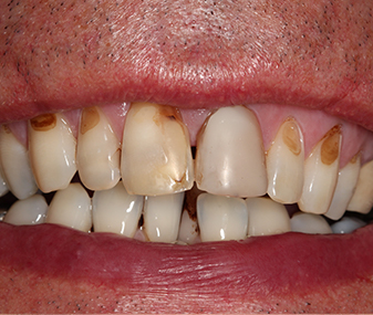 Before - Dentaria Dental