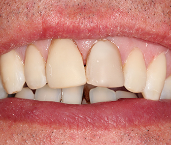 After - Dentaria Dental